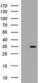 Ankyrin Repeat Domain 49 antibody, CF507228, Origene, Western Blot image 