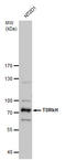 Tudor and KH domain-containing protein antibody, GTX129795, GeneTex, Western Blot image 