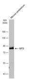 GIT ArfGAP 2 antibody, GTX133285, GeneTex, Western Blot image 