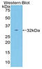 Activated Leukocyte Cell Adhesion Molecule antibody, LS-C292615, Lifespan Biosciences, Western Blot image 