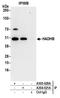 Hydroxyacyl-CoA Dehydrogenase Trifunctional Multienzyme Complex Subunit Beta antibody, A305-020A, Bethyl Labs, Immunoprecipitation image 