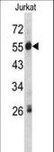 Serpin Family G Member 1 antibody, LS-C98408, Lifespan Biosciences, Western Blot image 