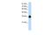 Polypyrimidine Tract Binding Protein 2 antibody, GTX30786, GeneTex, Western Blot image 