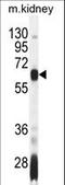 Autoimmune Regulator antibody, LS-C156200, Lifespan Biosciences, Western Blot image 