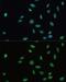 SET Nuclear Proto-Oncogene antibody, GTX55793, GeneTex, Immunocytochemistry image 