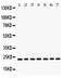 RAS Like Proto-Oncogene B antibody, PB9795, Boster Biological Technology, Western Blot image 