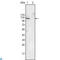 EPH Receptor B4 antibody, LS-C812460, Lifespan Biosciences, Western Blot image 