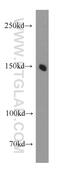 Protocadherin 11 Y-Linked antibody, 20069-1-AP, Proteintech Group, Western Blot image 