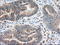 Insulin Like Growth Factor 2 MRNA Binding Protein 2 antibody, LS-C115283, Lifespan Biosciences, Immunohistochemistry frozen image 