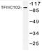 General Transcription Factor IIIC Subunit 3 antibody, AP20464PU-N, Origene, Western Blot image 