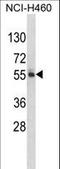 FTO Alpha-Ketoglutarate Dependent Dioxygenase antibody, LS-C166270, Lifespan Biosciences, Western Blot image 