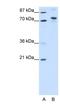 TOX high mobility group box family member 4 antibody, NBP1-80328, Novus Biologicals, Western Blot image 