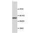 DnaJ Heat Shock Protein Family (Hsp40) Member B1 antibody, orb18040, Biorbyt, Western Blot image 