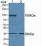 Amphiregulin antibody, LS-C714971, Lifespan Biosciences, Western Blot image 