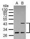 Inhibitor Of Growth Family Member 1 antibody, GTX102478, GeneTex, Western Blot image 
