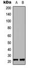 Mitochondrial Ribosomal Protein L35 antibody, LS-C358806, Lifespan Biosciences, Western Blot image 