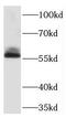Thymine DNA Glycosylase antibody, FNab08570, FineTest, Western Blot image 