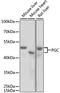 Progastricsin antibody, STJ24969, St John