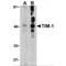 Hepatitis A Virus Cellular Receptor 1 antibody, MBS150916, MyBioSource, Western Blot image 