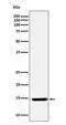 Cyclin Dependent Kinase Inhibitor 2A antibody, M00016-2, Boster Biological Technology, Western Blot image 