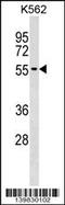 UTP3 Small Subunit Processome Component antibody, 60-298, ProSci, Western Blot image 