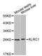 Killer Cell Lectin Like Receptor C1 antibody, A1233, ABclonal Technology, Western Blot image 