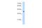 Kynurenine Aminotransferase 3 antibody, NBP1-70487, Novus Biologicals, Western Blot image 