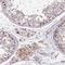 Diphthamide Biosynthesis 2 antibody, NBP2-13933, Novus Biologicals, Immunohistochemistry frozen image 