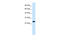 Regulator Of G Protein Signaling 13 antibody, 27-991, ProSci, Western Blot image 