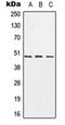 Carbohydrate Sulfotransferase 1 antibody, orb214802, Biorbyt, Western Blot image 