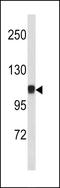 Catenin Alpha 1 antibody, LS-B9175, Lifespan Biosciences, Western Blot image 