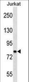 Calcium Voltage-Gated Channel Auxiliary Subunit Beta 2 antibody, LS-C168262, Lifespan Biosciences, Western Blot image 