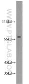 Carnitine Palmitoyltransferase 1C antibody, 12969-1-AP, Proteintech Group, Western Blot image 