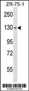 Hexokinase Domain Containing 1 antibody, 58-799, ProSci, Western Blot image 