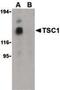 TSC Complex Subunit 1 antibody, PA5-20131, Invitrogen Antibodies, Western Blot image 