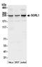 SORL1 antibody, A305-288A, Bethyl Labs, Western Blot image 