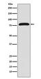 Transglutaminase 2 antibody, M02229-1, Boster Biological Technology, Western Blot image 