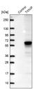 Thioredoxin Interacting Protein antibody, NBP2-49095, Novus Biologicals, Western Blot image 