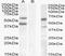 Diacylglycerol O-Acyltransferase 2 antibody, TA305692, Origene, Western Blot image 