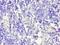 CD58 Molecule antibody, LS-C375416, Lifespan Biosciences, Immunohistochemistry paraffin image 