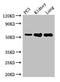 Matrix Metallopeptidase 13 antibody, LS-C318143, Lifespan Biosciences, Western Blot image 