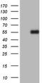 Plasminogen Activator, Urokinase antibody, LS-C339513, Lifespan Biosciences, Western Blot image 