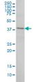 Rpo1-1 antibody, H00009533-M03, Novus Biologicals, Western Blot image 