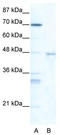 Heat Shock Transcription Factor 4 antibody, TA330645, Origene, Western Blot image 
