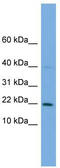 Protein Phosphatase 1 Regulatory Subunit 17 antibody, TA340131, Origene, Western Blot image 