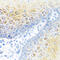 S100 Calcium Binding Protein A7 antibody, abx006275, Abbexa, Western Blot image 
