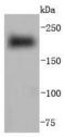 Myosin Heavy Chain 6 antibody, A02808-1, Boster Biological Technology, Western Blot image 