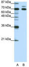 Tripartite Motif Containing 16 antibody, TA343611, Origene, Western Blot image 