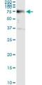 Adrenocortical dysplasia protein homolog antibody, H00065057-M02, Novus Biologicals, Immunoprecipitation image 