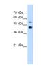 GTP Binding Protein 2 antibody, NBP1-57649, Novus Biologicals, Western Blot image 